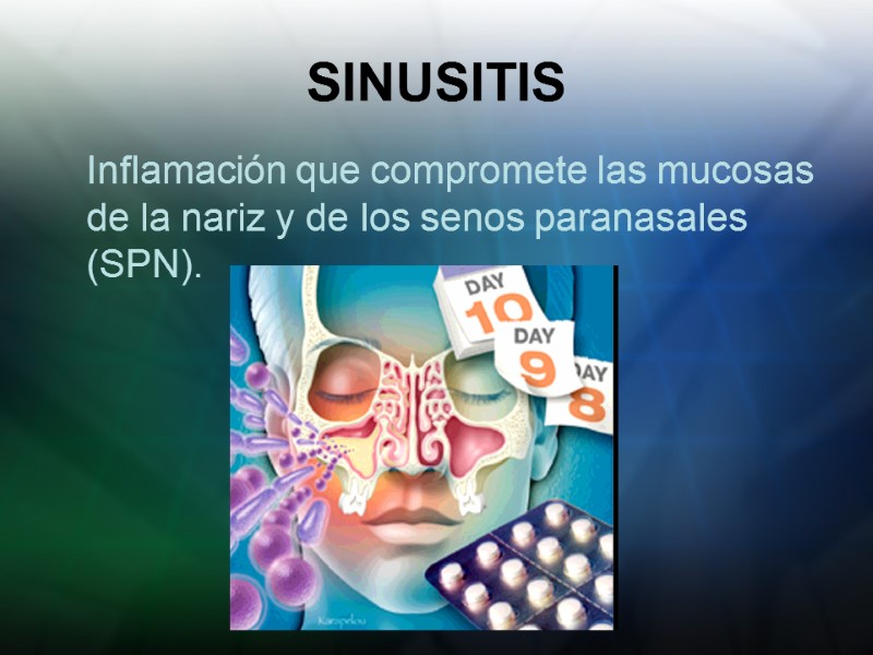 SINUSITIS  Inflamación que compromete las mucosas de la nariz y de los senos